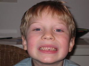 William without his Tooth
